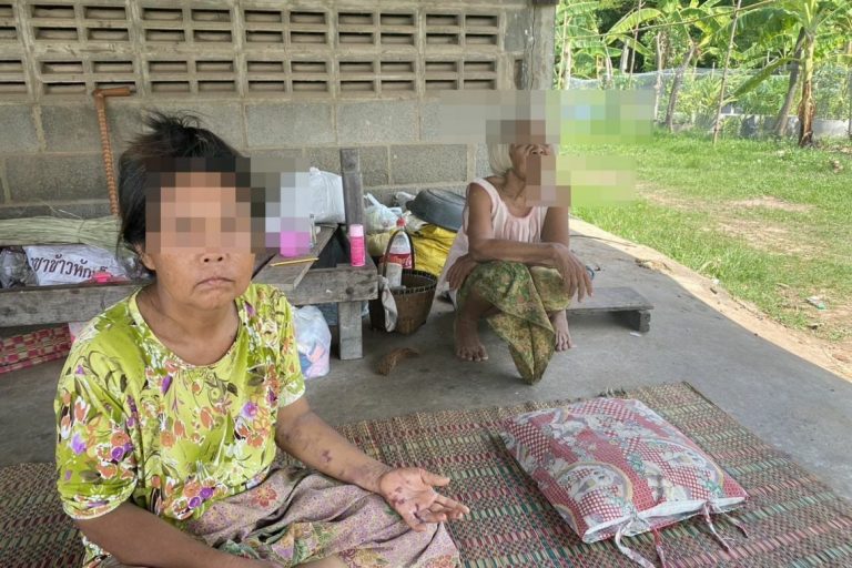 Contaminated Water Supply Leaves Residents In Buriram With Painful Rashes and Sores